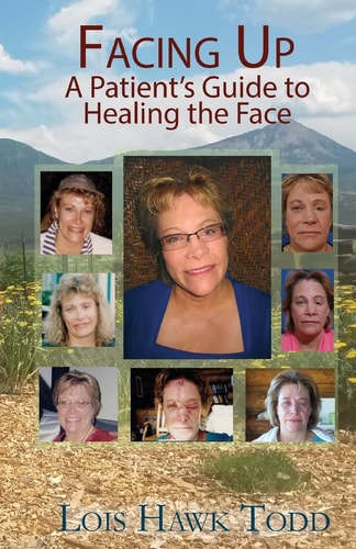 Facing Up A Patient's Guide to Healing the Face