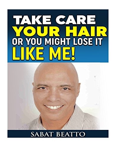 Take Care Your Hair Or You Might Lose It Like Me!