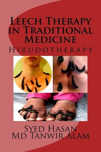 Leech Therapy in Traditional Medicine Hirudotherapy