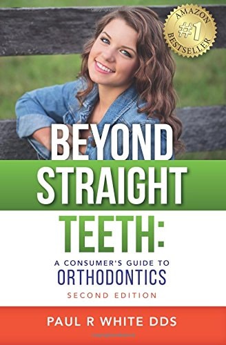Beyond Straight Teeth A Consumer's Guide to Orthodontics
