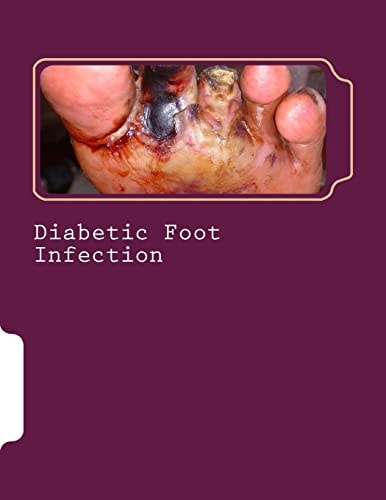 Diabetic Foot Infection