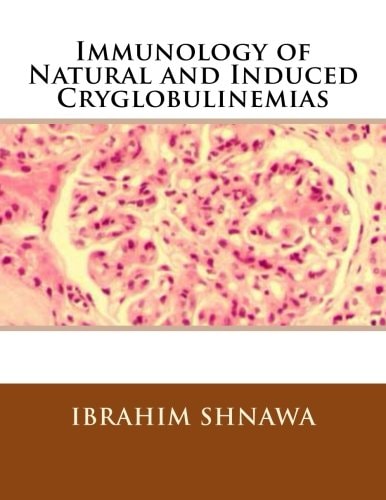 Immunology of Natural and Induced Cryoglobulinemia