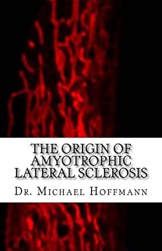 The Origin of Amyotrophic Lateral Sclerosis