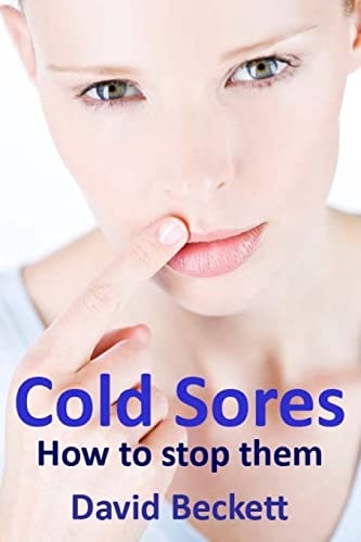 Cold Sores How to Stop Them