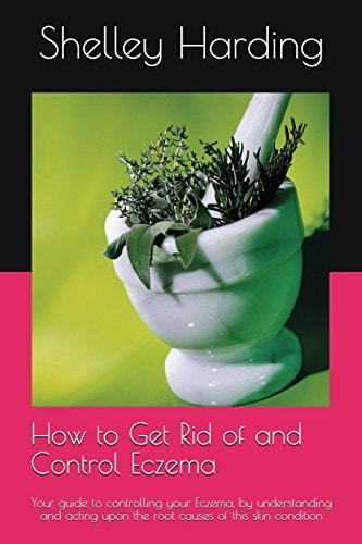 How to Get Rid of and Control Eczema Your Guide to Controlling Your Eczema, by Understanding and Acting Upon the Root Causes of this Skin Condition