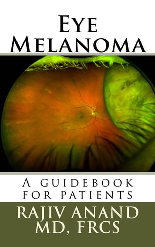 Eye Melanoma A Manual for Patients