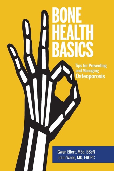 Bone Health Basics: Tips for Preventing and Managing Osteoporosis