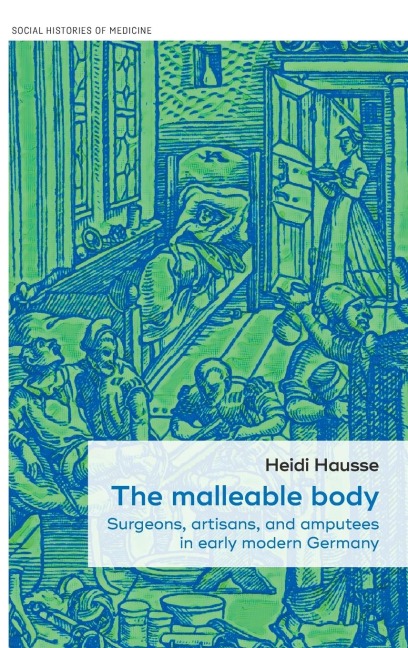 The malleable body: Surgeons, artisans, and amputees in early modern Germany