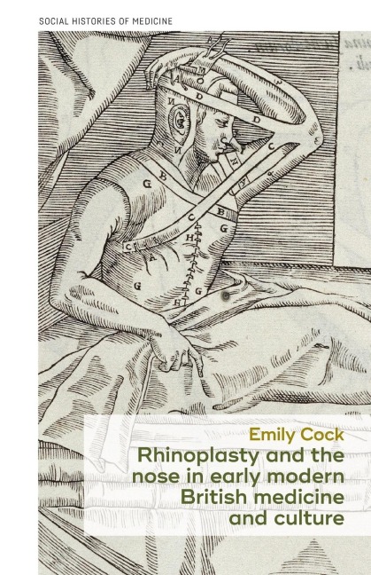 Rhinoplasty and the nose in early modern British medicine and culture