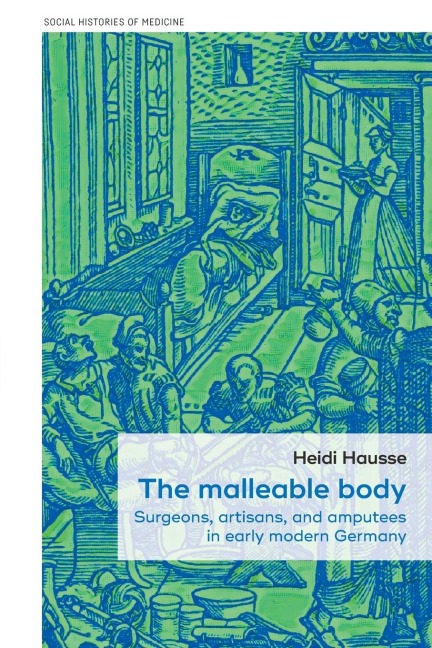 The malleable body: Surgeons, artisans, and amputees in early modern Germany