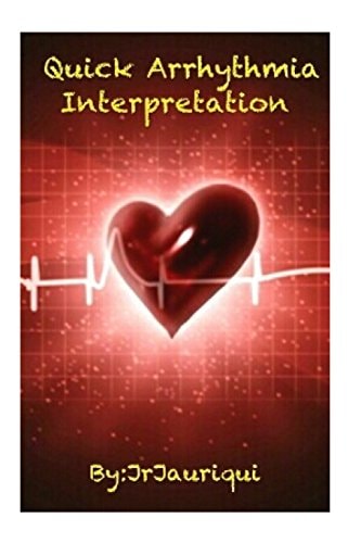 Quick Arrhythmia Interpretation ECG Interpretation
