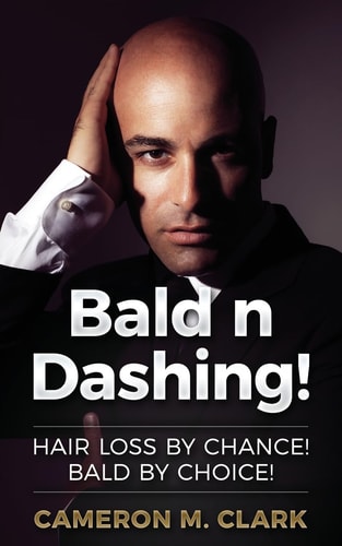 Bald N Dashing! Hair Loss by Chance, Bald by Choice!