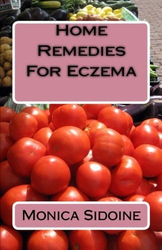 Home Remedies For Eczema