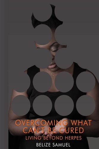 Overcoming What Can't Be Cured Living Beyond Herpes
