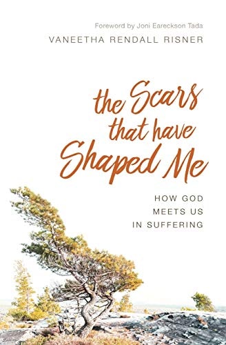 The Scars That Have Shaped Me How God Meets Us in Suffering