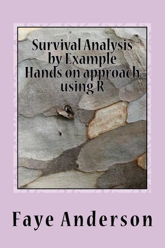 Survival Analysis by Example Hands on Approach Using R