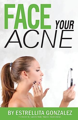 Face Your Acne