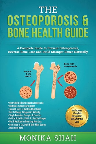 Osteoporosis The Osteoporosis and Bone Health Guide: a Complete Guide to Prevent Osteoporosis, Reverse Bone Loss and Build Stronger Bones Naturally