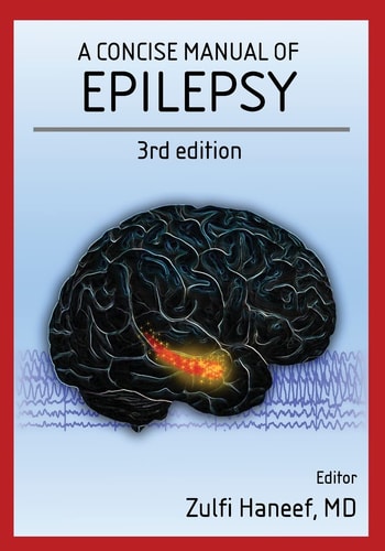 A Concise Manual of Epilepsy 3rd Edition