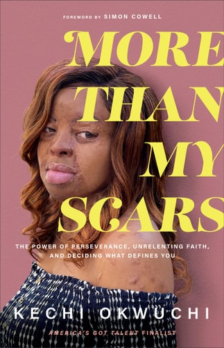 More Than My Scars The Power of Perseverance, Unrelenting Faith, and Deciding what Defines You