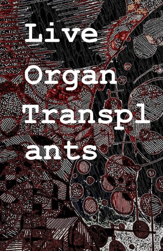 Live Organ Transplants