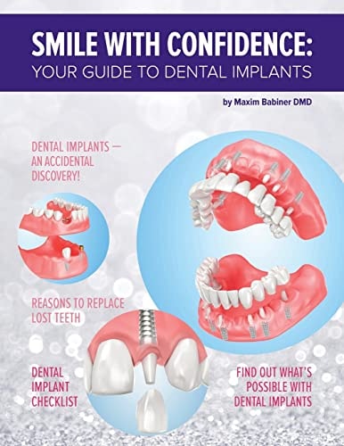 Smile with Confidence Your Guide to Dental Implants