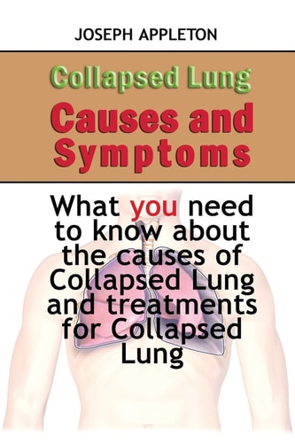 Collapsed Lung Causes and Symptoms What You Need to Know about the Causes of Collapsed Lung and Treatments for Collapsed Lung