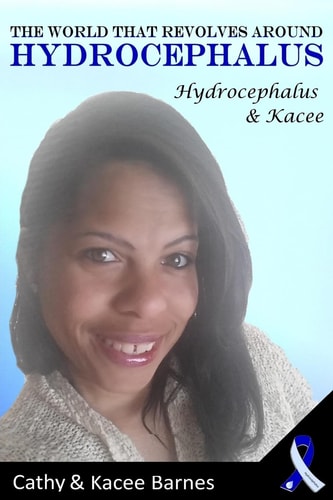 The World That Revolves Around Hydrocephalus Hydrocephalus and Kacee