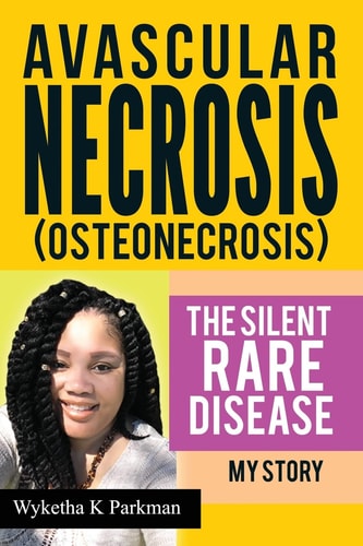 Avascular Necrosis (Osteonecrosis) The Silent Rare Disease My Story
