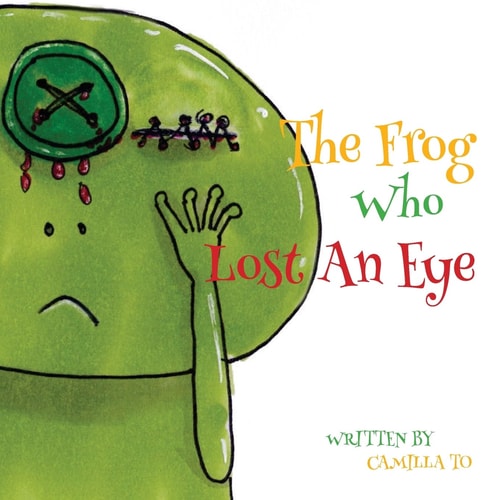 The Frog Who Lost An Eye This is a Story about a Frog and His Unfortunate Encounters.