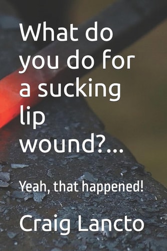 What Do You Do for a Sucking Lip Wound?... Yeah, That Happened!