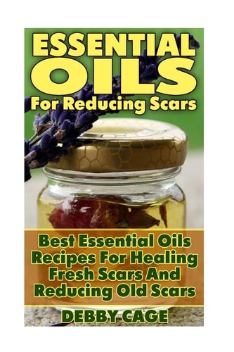 Essential Oils For Reducing Scars Best Essential Oils Recipes For Healing Fresh Scars And Reducing Old Scars