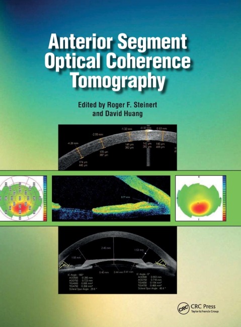 Anterior Segment Optical Coherence Tomography