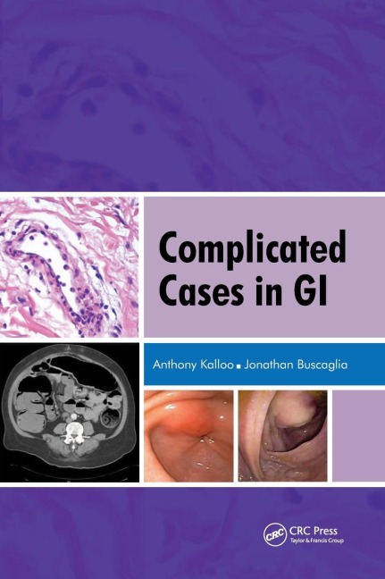 Complicated Cases in GI