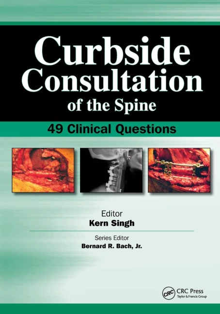 Curbside Consultation of the Spine: 49 Clinical Questions
