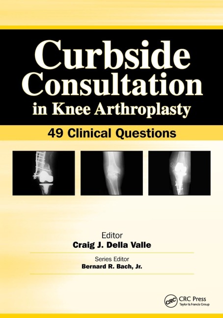 Curbside Consultation in Knee Arthroplasty: 49 Clinical Questions