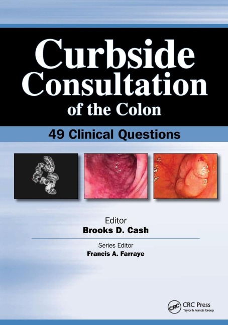 Curbside Consultation of the Colon: 49 Clinical Questions