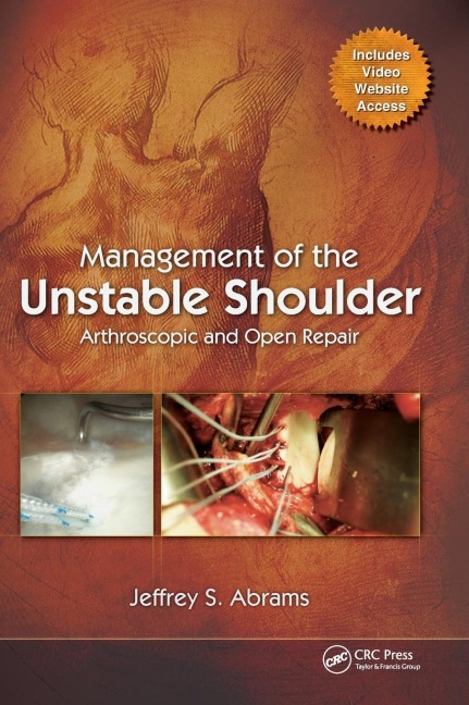 Management of the Unstable Shoulder: Arthroscopic and Open Repair