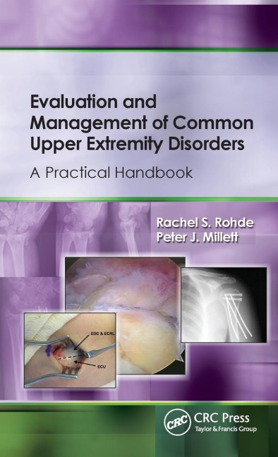 Evaluation and Management of Common Upper Extremity Disorders: A Practical Handbook