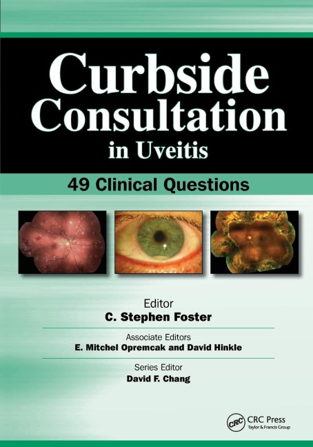Curbside Consultation in Uveitis: 49 Clinical Questions