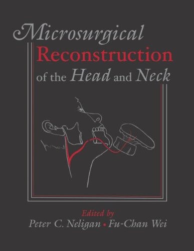Microsurgical Reconstruction of the Head and Neck