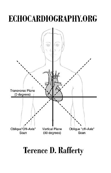 Echocardiography.Org