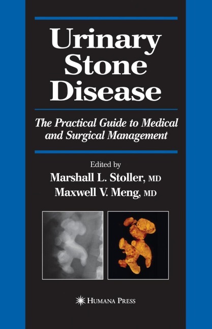 Urinary Stone Disease: The Practical Guide to Medical and Surgical Management