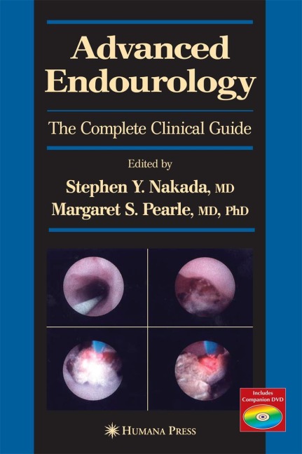 Advanced Endourology: The Complete Clinical Guide