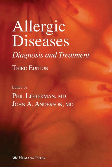 Allergic Diseases: Diagnosis and Treatment