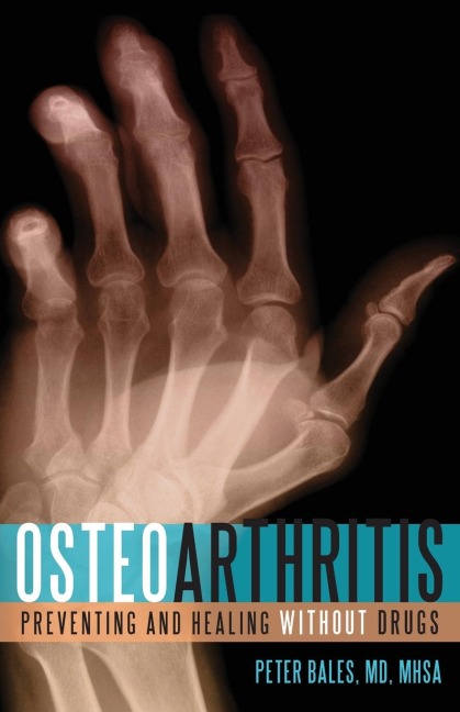 Osteoarthritis: Preventing and Healing Without Drugs
