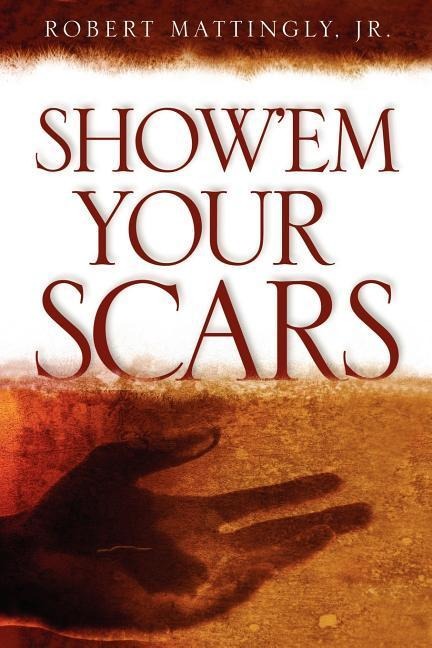Showem Your Scars