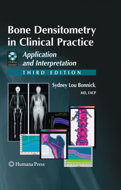Bone Densitometry in Clinical Practice: Application and Interpretation