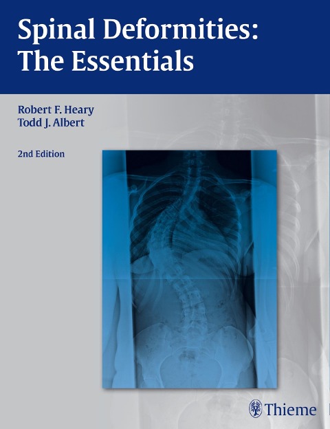 Spinal Deformities: The Essentials