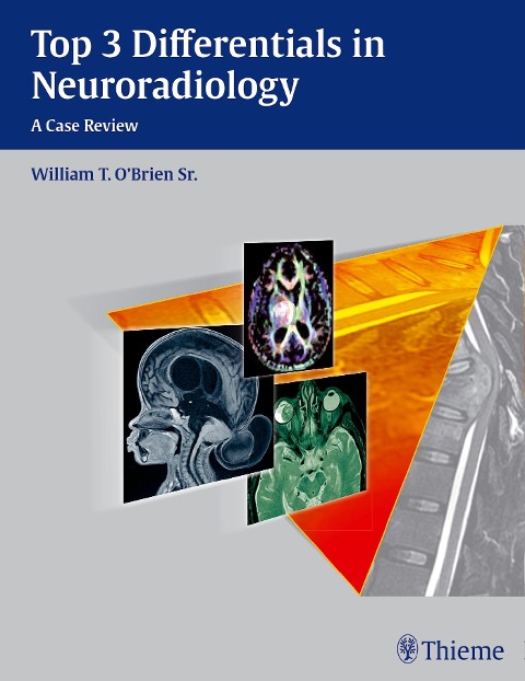 Top 3 Differentials in Neuroradiology: A Case Review